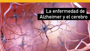 Una mirada hacia el universitario con familiar con Alzheimer